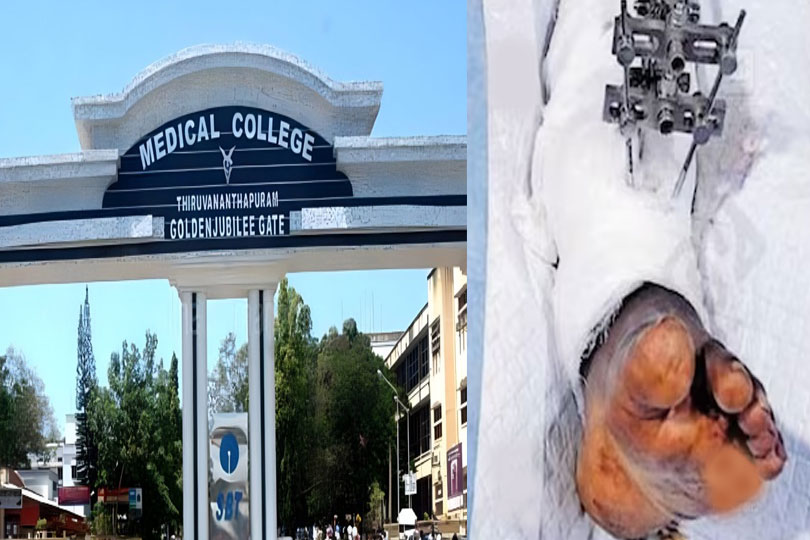 മെഡിക്കല്‍ കോളേജില്‍ ശസ്ത്രക്രിയ കഴിഞ്ഞ രോഗിയുടെ കാലില്‍ പുഴുവരിച്ച സംഭവത്തില്‍ ഡ്യൂട്ടി ഡോക്ടറെ സസ്‌പെൻഡ് ചെയ്തു.